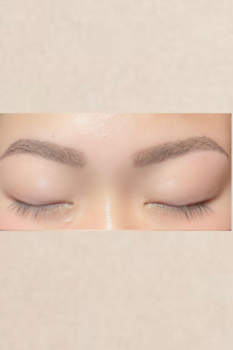 parisienne brow lift