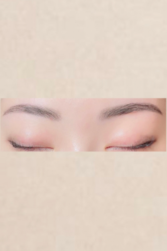 parisienne brow lift