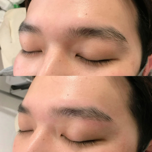 アイブロウWAX脱毛
