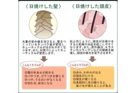 日焼け